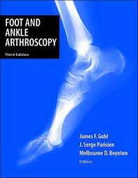 Foot and Ankle Arthroscopy  