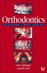 Orthodontics Picture Test Atlas  