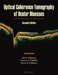 Optical Coherence Tomography of Ocular Diseases / Edition 2  