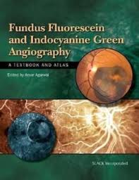 Fundus Fluorescein and Indocyanine Green Angiography : A Textbook and Atlas  