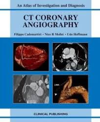Ct Coronary Angiography : An Atlas of Investigation and Diagnosis  