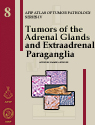 Tumors of the Adrenal Glands and Extraadrenal Paraganglia 