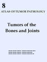 Tumors of Bones and Joints 