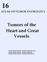 Tumors of the Heart and Great Vessels 