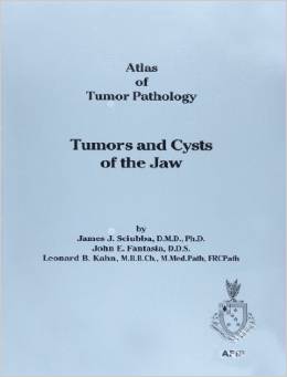Tumors and Cysts of the Jaw 
