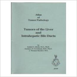 Tumors of the Liver and Intrahepatic Bile Ducts 