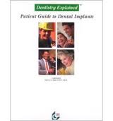 Dentistry Explained : A Patient Guide to Dental Implants  