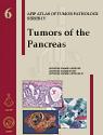 Tumors of the Pancreas 