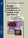 Benign and Reactive Conditions of Lymph Node and Spleen 