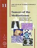 Tumors of the Mediastinum  