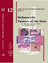 Melanocytic Tumors of the Skin 