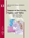 Tumors of the Cervix, Vagina, and Vulva 