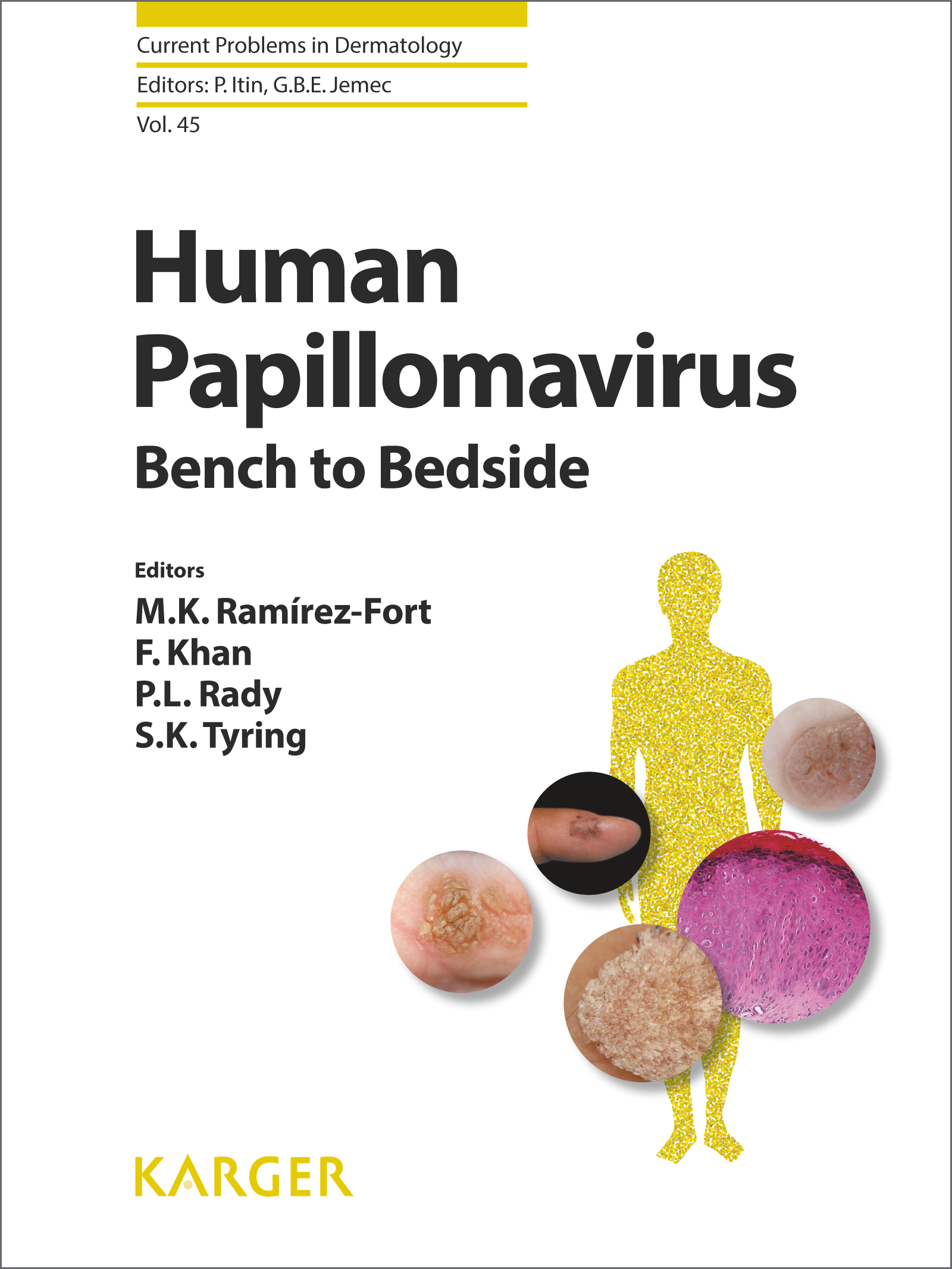 Human Papillomavirus 
