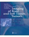 Imaging of Bone and Soft Tissue Tumors : A Case Study Approach  