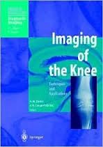 Imaging of the Knee  