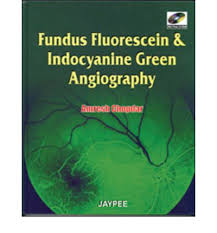 Fundus Fluorescem and indocysine Green Angrogrophy  