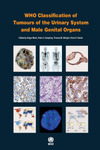 WHO Classification of Tumours of the Urinary System and Male Genital Organs 