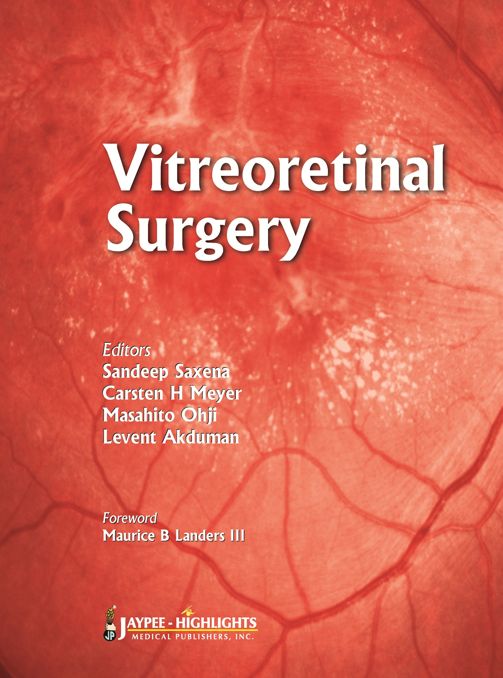Vitreoretinal Surgery 