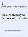 Non-Melanocytic Tumors of the Skin 