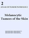 Melanocytic Tumors of the Skin 